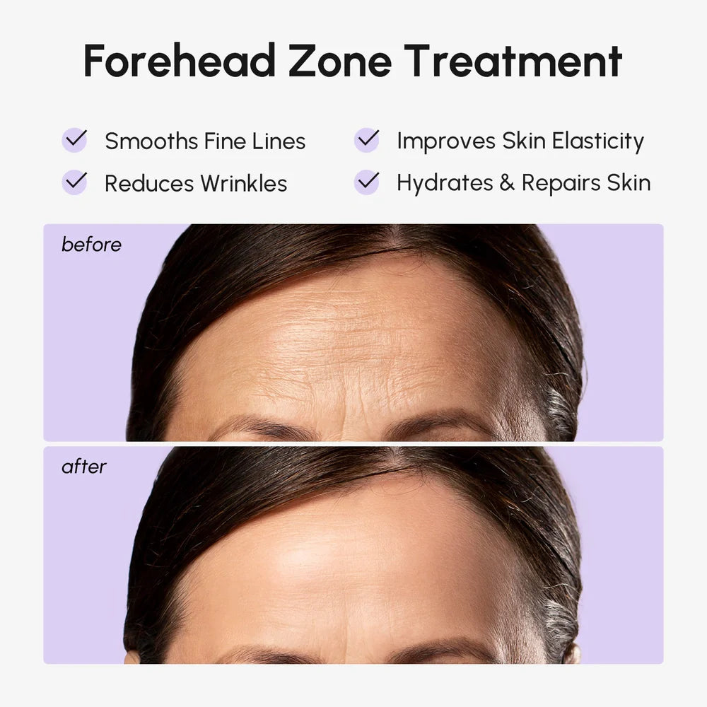 Maree® Smoothing Forehead Patches